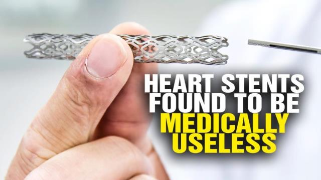 BOMBSHELL as heart stents found to be medically USELESS