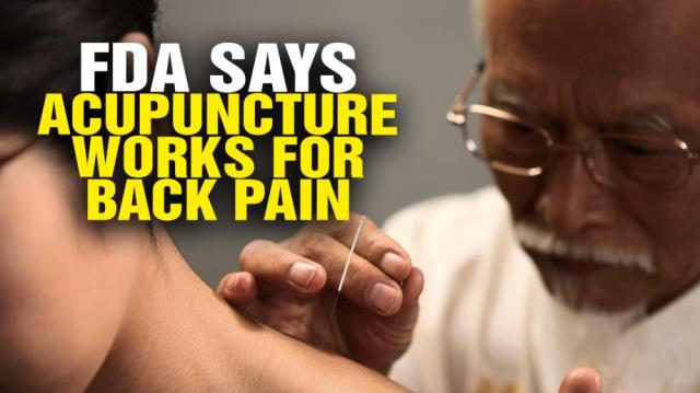 FDA wants doctors to recommend acupuncture and chiropractic care for back pain