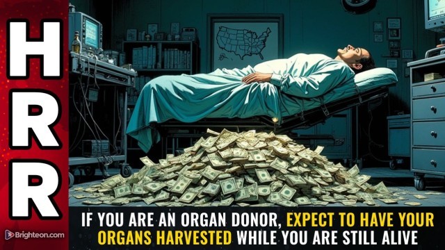 If you are an ORGAN DONOR, expect to have your organs harvested while you are STILL ALIVE