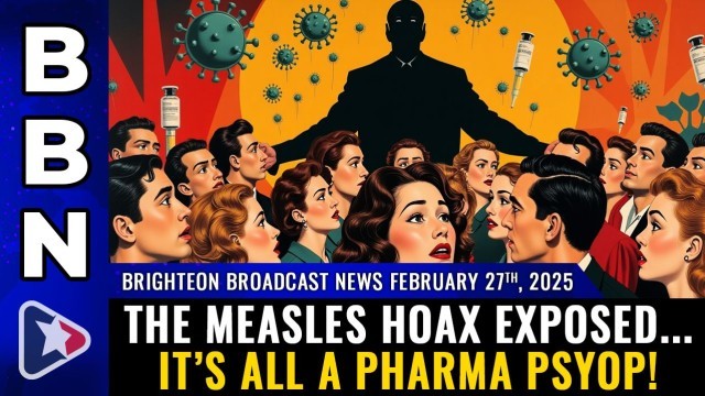 The MEASLES HOAX exposed... It's all a PHARMA PSYOP!